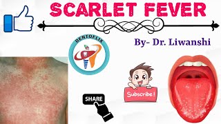 Scarlet Fever in 5 Minutes  Oral Pathology [upl. by Nyasuh]