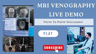 MRI Brain Venography live demo amp post processing filming How to do MRI venography [upl. by Iznik901]