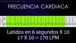 Electrocardiografía Básica Parte 24 [upl. by Rosabelle728]