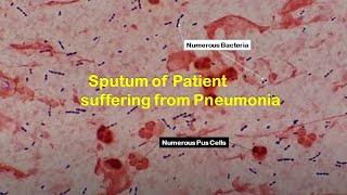 Pneumonia causing Bacteria under the Microscope [upl. by Caressa987]