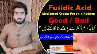 Fudic H Fusidic Acid Cream Uses  Side Effects  How to Use Fudic H Cream  Beauty Facts [upl. by Sammie]