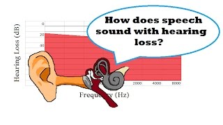 How Does Speech Sound with Hearing Loss [upl. by Cullan501]