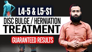 Get Rid Of L4 L5 And L5 S1 Disc Bulge With This Home Treatment  Guaranteed Results [upl. by Eneg864]