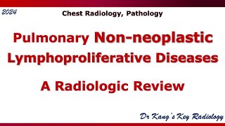 Pulmonary Nonneoplastic lymphoproliferative disease LPD [upl. by Macy504]