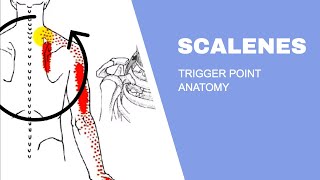 Scalenes Trigger Points [upl. by Enihpad]