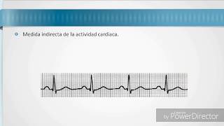 INTERPRETACIÓN DEL ELECTROCARDIOGRAMA [upl. by Duck]