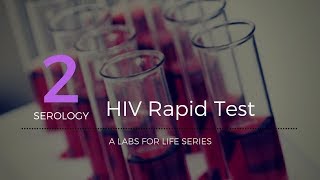 HIV Rapid Test [upl. by Enitsyrk68]