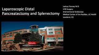 Laparoscopic distal pancreatectomy with splenectomy [upl. by Jillana287]