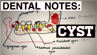 CYST  INTRODUCTION  DEFINITION  CLASSIFICATION [upl. by Elinor672]