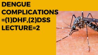 Dengue complications DHF and DSS lectures 2 [upl. by Buell]