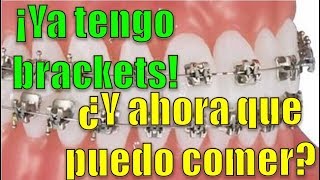 ¡Ya tengo brackets ¿Y ahora que puedo comer [upl. by Dickson]