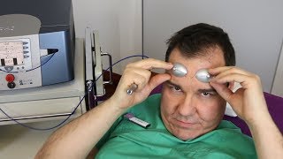 Äderchen im Gesicht  Dr Günther lasert sich selbst  Video Erfahrungsbericht Laserbehandlung [upl. by Helsie]