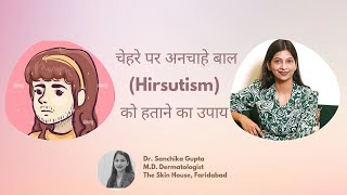 Hirsutism चेहरे पर अनचाहे बाल   Causes amp Treatment Dr Sanchika Gupta dermatologistinfaridabad [upl. by Okihcas]