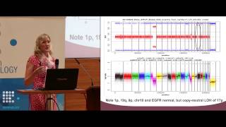 Use of Oncoscan FFPE Assay and Molecular Inversion Probe [upl. by Bartie]