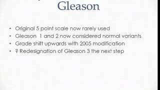 Is Gleason 336 Really Cancer No Prof L Klotz [upl. by Annelise]