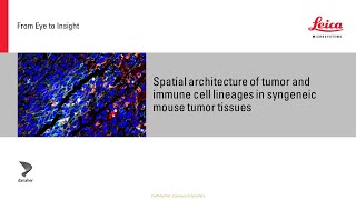 Spatial architecture of tumor and immune cells in tumor tissues [upl. by Ellener]