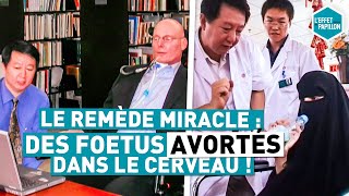 LE REMÈDE MIRACLE  DES FOETUS AVORTÉS DANS LE CERVEAU [upl. by Helban]