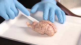 Carolina Quick Tip® Sheep Brain Dissection [upl. by Herold]