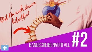 Bandscheibenvorfall😲Das passiert in Deinem Köper⚠️ [upl. by Airan995]