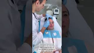 Botox Injection Preparation and Precision Placement for Wrinkle Treatment [upl. by Luciano114]