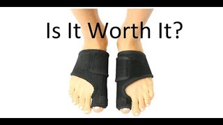 Bunion Splints and Correctors Are They Worth It Doctor Review [upl. by Odille]