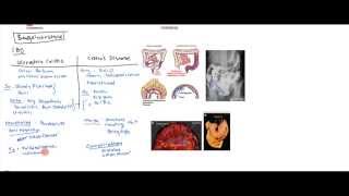 Inflammatory Bowel Disease Crohns and Ulcerative Colitis for USMLE Step 1 [upl. by Arihsaj]