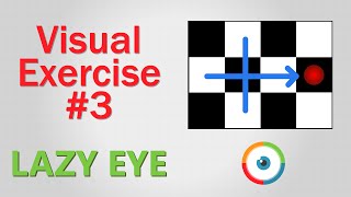 Lazy Eye Exercise 03 [upl. by Elita]