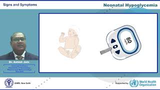 Neonatal Hypoglycemia [upl. by Leake962]