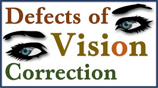 Human Eye Part 4  Defects of Vision and Correction  Class 10 Science  Human Eye Defects of Vision [upl. by Aneen]