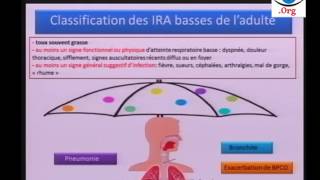 Cas Clinique sur la Pneumonie  Première Partie [upl. by Nuawed393]