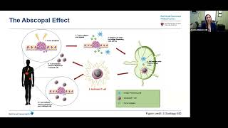 Webinar Novel treatment approaches for intrahepatic cholangiocarcinoma [upl. by Ailekat]