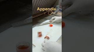 Appendix specimen [upl. by Amabelle]