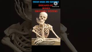 Bone। diseases of bone। skeletal system।shortsfeed trending । [upl. by Fita584]