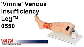 0550  Vinnie Venous Insufficiency Leg™ [upl. by Ovida]