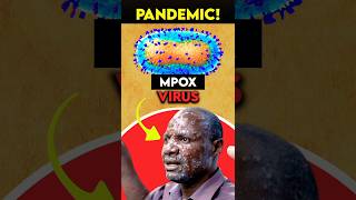 ALERT New PANDEMIC is Spreading Across The World  MPOX Virus Explained [upl. by Asyar]