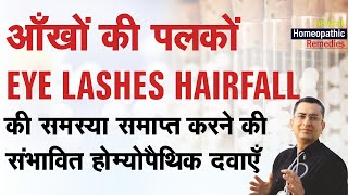 आँखों की पलकें झड़ना  Madarosis  Milphosis  Eye Lashes Hairfall  Natural Homeopathic remedies [upl. by Nirot]