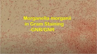 Gram Negative Rods of Morganella morganii in Gram Staining [upl. by Ahsillek]