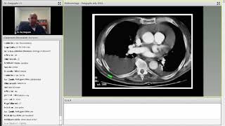 Step2 2CK IM Pulmonary Medicine [upl. by Dimitri]