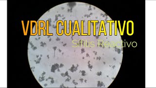 VDRL Cualitativo [upl. by Carilla]