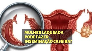 Quem é LAQUEADA pode fazer INSEMINAÇÃO CASEIRA [upl. by Frannie334]