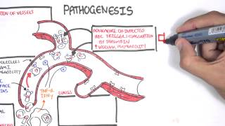 Malaria Pathophysiology [upl. by Ardnasxela]