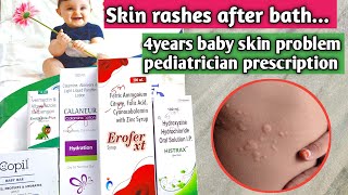 4 years baby skin rashes control with calamine lotion amp copil soap amp Atarax syrup [upl. by Junji]