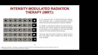 Principios de Radioterapia en tumores cerebrales [upl. by Beeson232]