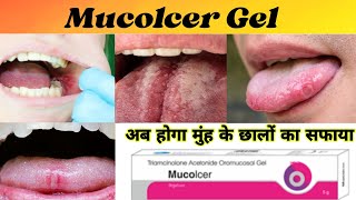 Mucolcer Gel  Mucolcer Gel uses  Mucolcer in hindi [upl. by Tillo]