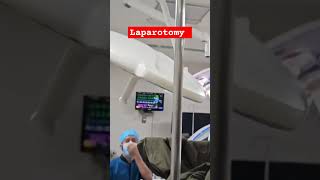 Laparotomy shorts youtubeshorts viralshort motivational healthtips surgeondoctor surgeryday [upl. by Zillah]