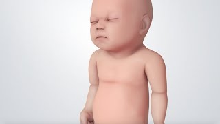 Infant Distress Warning Signs Grunting Baby Sound [upl. by Niatsirk]