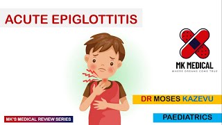 Acute Epiglottitis [upl. by Adalie944]