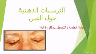 الترسبات الدهنية حول العين اللويحة الصفراء 🔹اسبابها 🔸علاجها 🔹xanthelasma [upl. by Marcell]