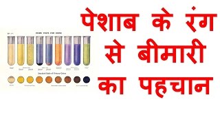 पेशाब के रंग से बीमारी की पहचान  Urine color health problems in Hindi Gyan ki Baatein [upl. by Eldnek]