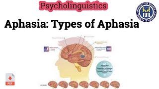 Aphasia  Types of Aphasia [upl. by Eidissac]